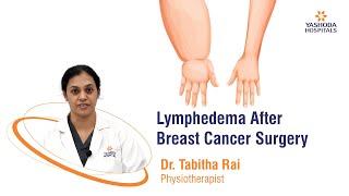 Lymphedema After Breast Cancer Surgery | Yashoda Hospitals Hyderabad