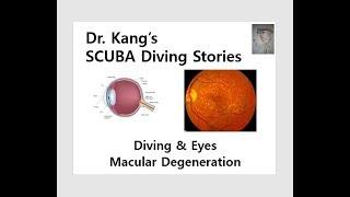 Dr. Kang's SCUBA Diving Stories - Macula Degeneration and Diving