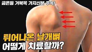 익상견갑 (Scapular winging)을 치료하는 운동 방법