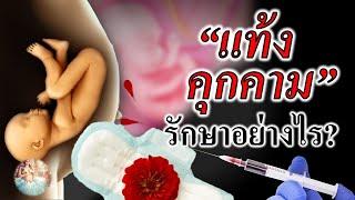 อาการคนท้อง : ภาวะแท้งคุกคาม รักษาอย่างไร? | อาการตั้งครรภ์ | คนท้อง Everything