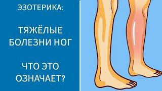 ТЯЖЁЛЫЕ БОЛЕЗНИ НОГ. ЧТО ЭТО ОЗНАЧАЕТ?