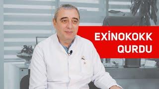 Exinokokk qurdu - Ümumi cərrahı Dr. Anar Məmmədov