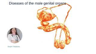 Diseases of the male genital organs