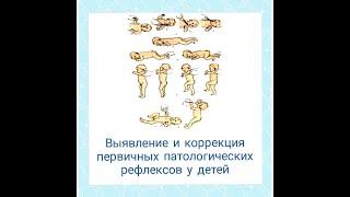 Выявление и коррекция первичных патологических рефлексов у детей / отрывок семинара