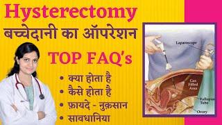 बच्चेदानी का ऑपरेशन क्या, क्यों और कैसे होता है | Hysterectomy Recovery | Laparoscopic Hysterectomy