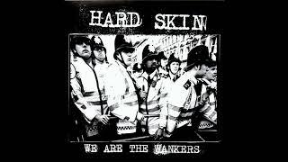 HARD SKIN - We Are The Wankers 2013 [FULL EP]