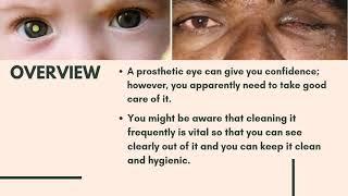 Artificial eye service in Gujarat, कृत्रिम आंख बनवाईये