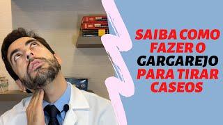 Saiba como fazer a LIMPEZA PARA RETIRAR OS CÁSEOS de suas amígdalas - Dr. Paulo Mendes Jr