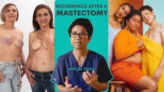 Recurrence of Breast Cancer Even after a Mastectomy - with Dr Tasha