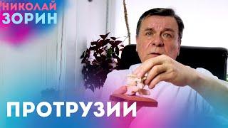 Протрузии межпозвонковых дисков. Ответы на вопросы зрителей