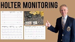 Holter Monitor | Everything you need to know