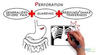 Gastroenterology - Acute Non-Traumatic Abdominal Pain: By Heather Murray M.D.