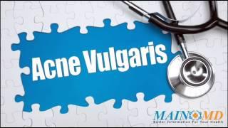 Acne Vulgaris ¦ Treatment and Symptoms