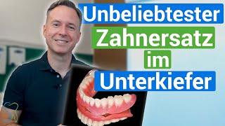 Der Unbeliebteste Zahnersatz im Unterkiefer ️| Wir raten dir davon ab️