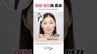 #shorts 옆볼필러, 의외의 효과 The effect of side cheek filler