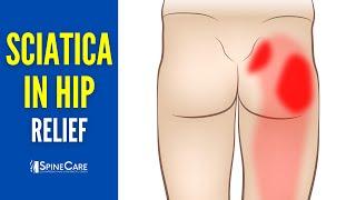 How to INSTANTLY Relieve Sciatica Pain in the Hip
