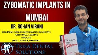 Zygomatic Implant in Mumbai | Basal Implants in Mumbai | Full mouth Dental Implant in Mumbai