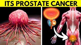 Prostate Cancer: Early Symptoms You Should Never Ignore