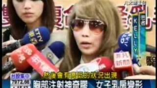 雅丰麗緻診所整形外科林孟羲醫師 雙面複合式隆乳八大新聞.WMV