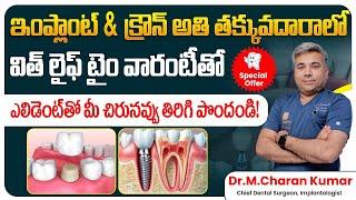 Eledent Offers Titanium Implants & Zinc-Crony Crown at an Unbeatable Price | EledentDental Hospitals