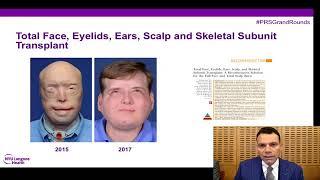 #PRSGrandRounds: Face Transplantation - Current State & Future Directions