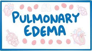 Pulmonary Edema - causes, symptoms, diagnosis, treatment, pathology