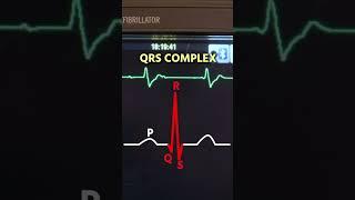 3rd DEGREE HEART BLOCK