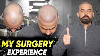 Hair Transplant in Sirsa | Best Results & Cost of Hair Transplant in Sirsa