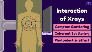 Scattering of X-rays | Compton | Coherent | Photoelectric effect | Oral radiology | Animated