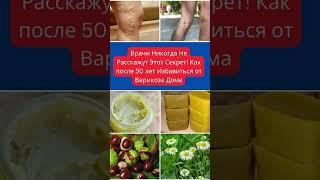 Врачи Никогда Не Расскажут Этот Секрет! Как после 50 Избавиться от Варикоза Дома #shorts