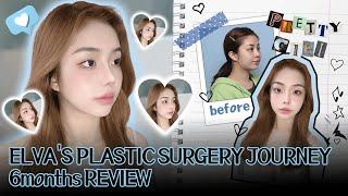 Dramatic Results with Just 2 Surgeries(KOREA PLASTIC SURGRGERY TRANSFORMATION)