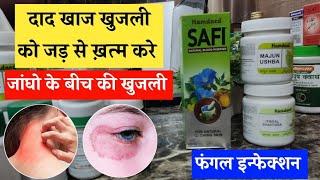 Daad, khaj, khujli, Eczema, Psoriasis ki dawae | Skin pareshani ka Ayurvedic treatment | Unani Gyan