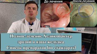 Лечим Хр. Язву желудка, эрозии и хеликобактер! За один раз и на долго. Видео До и После лечения.