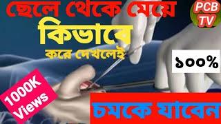 ছেলে থেকে মেয়ে কিভাবে করে প্লাস্টিক সার্জারি  দেখুন।See how plastic surgery a girl from boy. PCB TV