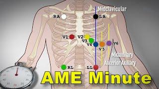 AME Minute: Why are ECGs frequently repeated?