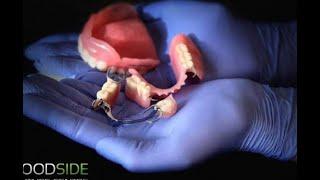 Complete Denture Services Airdrie | Woodside Denture Centre