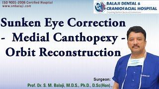 Sunken eye correction - Medial canthopexy - Orbit Reconstruction
