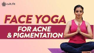 Face Yoga For Acne And Pigmentation | Face Yoga For Youthful Skin | Face Yoga Workout | CultFit