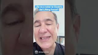 La cicatriz en el Lifting Facial. #shorts #liftingfacial #rejuvenescimento #cirujanoplasticobogota