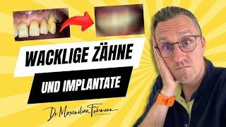 Wacklige Zähne & Implantate  | Zahnarzt Dr. Maximilian Fuhrmann