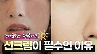 선크림을 제대로 바르지 않으면 생기는 일 (#자외선차단 #자외선차단제 #선크림 )