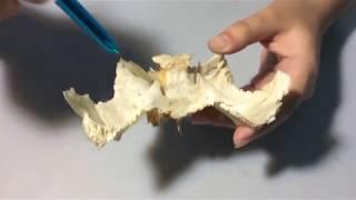 Sphenoid Bone