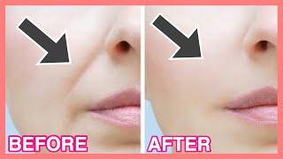 Smile Lines Facial Exercises & Massage (Nasolabial Folds/ Laugh Lines) Part3