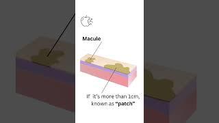 Bite-sized MRCP - Dermatology Part 6  - Macule #mrcp #bitesizedmrcp #skincare #dermatology #revision