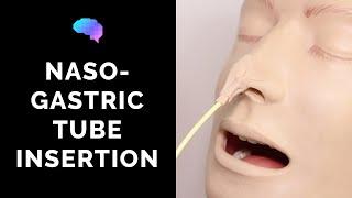 Nasogastric (NG) Tube Insertion - OSCE Guide | UKMLA | CPSA | PLAB 2