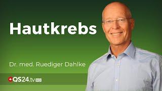 Dahlke: Hautkrebs durch Sonne - richtig? | Dr. med. Rüdiger Dahlke | Naturmedizin | QS24