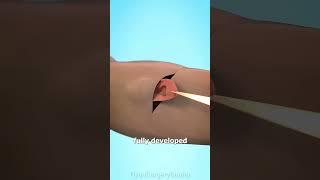 https: Gyan surgery studio