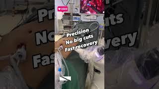 this is not VIDEO GAME_Hernia Surgery with Robotic operation in India 