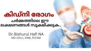 Kidney diseases and skin health: Dr Bishurul Hafi MD