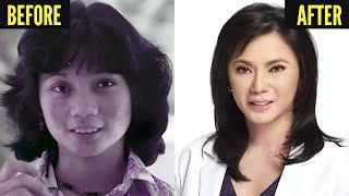 Famous Filipina Celebrities Plastic Surgery Disasters